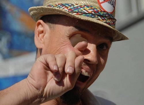 Billy Owen là người đàn ông bị một dạng hiếm của ung thư. Các bác sĩ đã phải loại bỏ khoang mũi của Billy và các tấm che phủ vòm miệng của anh. Đó là lý do anh có thể thọc ngón tay của mình như thế này.